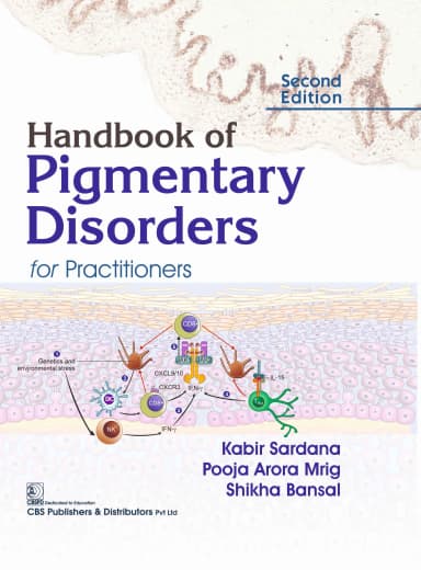 Image of - Handbook of Pigmentary Disorders for Practitioners | 2nd Edition | Hardcover