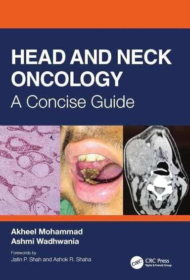 Image of - Head And Neck Oncology A Concise Guide | Paperback