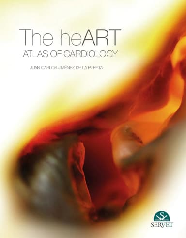 Image of - The Heart Atlas of Cardiology | Hardcover