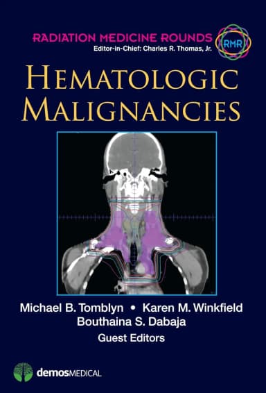 Image of - Hematologic Malignancies | Hardcover