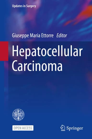 Image of - Hepatocellular Carcinoma | Paperback