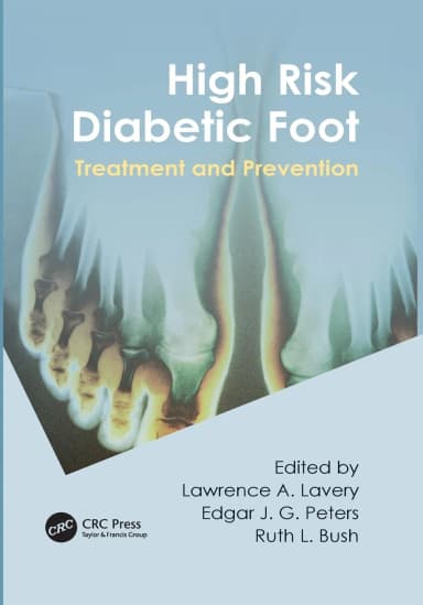 Image of - High Risk Diabetic Foot Treatment and Prevention | Paperback