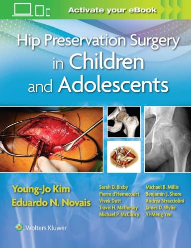 Image of - Hip Preservation Surgery In Children And Adolescents | Hardcover