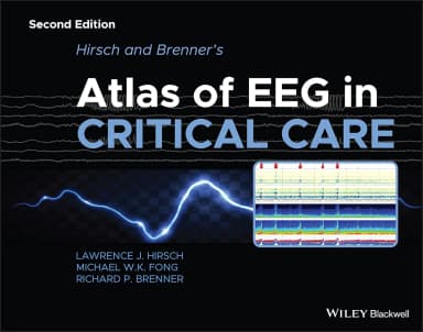 Image of - Hirsch And Brenners Atlas Of Eeg In Critical Care 2nd Edition | Hardcover