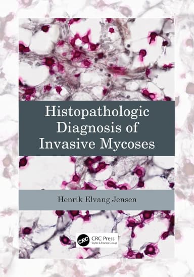 Image of - Histopathologic Diagnosis Of Invasive Mycoses | Paperback