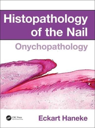 Image of - Histopathology of the Nail Onychopathology | Hardcover