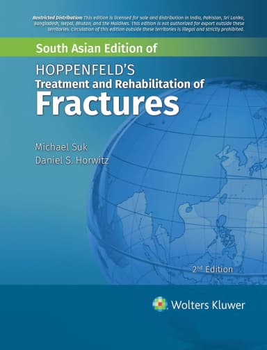 Image of - Hoppenfelds Treatment And Rehabilitation Of Fractures 2nd Edition | Paperback