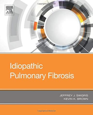 Image of - Idiopathic Pulmonary Fibrosis | Paperback