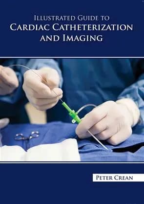 Image of - Illustrated Guide To Cardiac Catheterization And Imaging | Hardcover