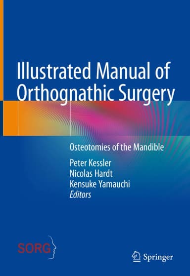 Image of - Illustrated Manual Of Orthognathic Surgery Osteotomies Of The Mandible | Hardcover