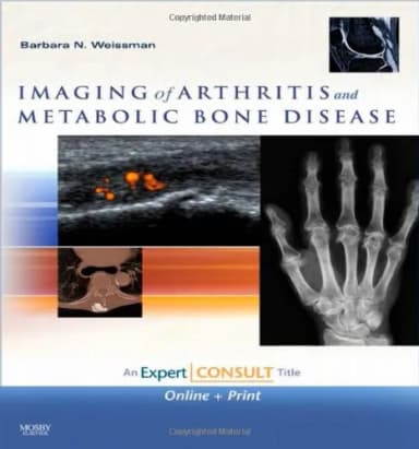 Image of - Imaging of Arthritis and Metabolic Bone Disease | Hardcover
