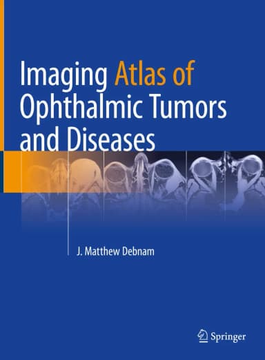 Image of - Imaging Atlas Of Ophthalmic Tumors And Diseases | Hardcover