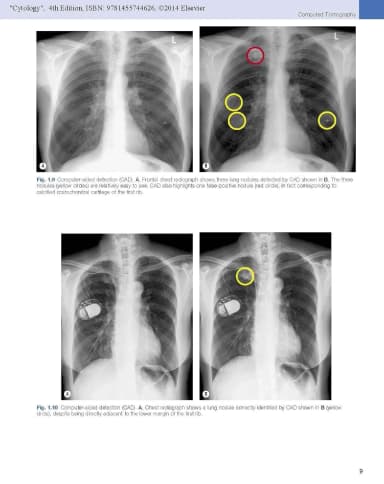 Image of - Imaging of Diseases of the Chest | 5th Edition | Hardcover