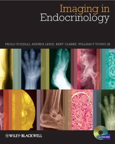 Image of - Imaging in Endocrinology | Hardcover