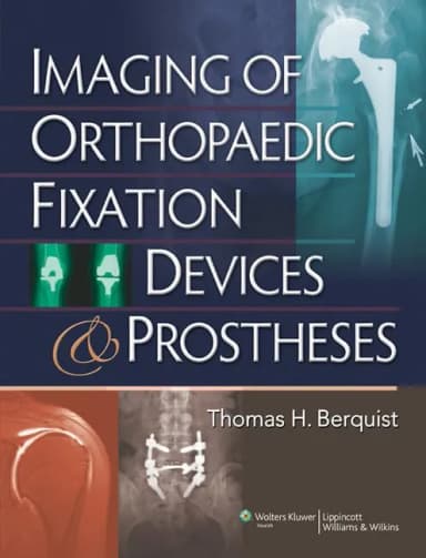 Image of - Imaging Of Orthopaedic Fixation Devices And Prostheses | Hardcover