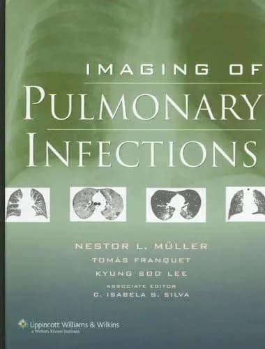Image of - Imaging Of Pulmonary Infections | Hardcover
