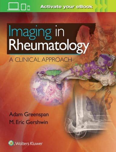 Image of - Imaging in Rheumatology A Clinical Approach | Hardcover