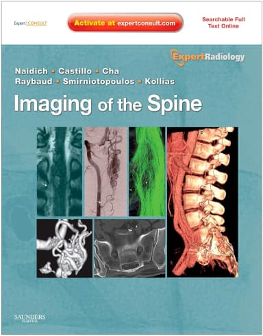 Image of - Imaging of the Spine Expert Radiology Series | Expert Consult-Online and Print | Hardcover