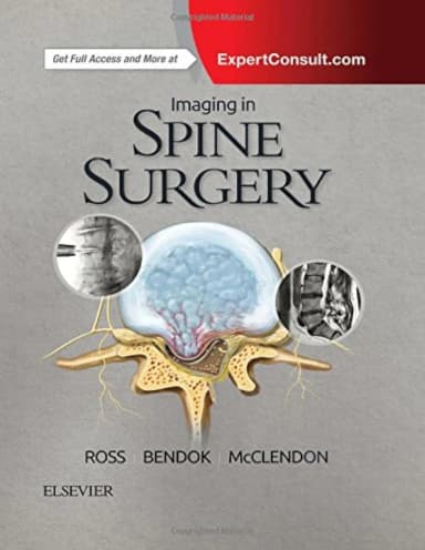 Image of - Imaging in Spine Surgery | Hardcover