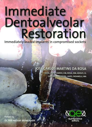 Image of - Immediate Dentoalveolar Restoration | Hardcover