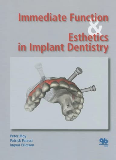 Image of - Immediate Function and Esthetics in Implant Dentistry | Hardcover