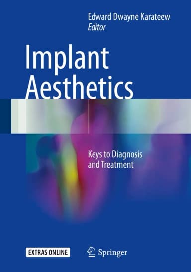 Image of - Implant Aesthetics | Hardcover