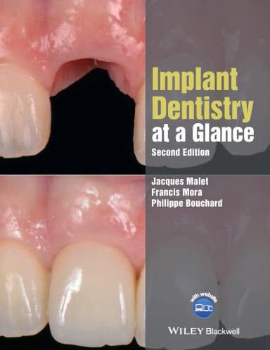 Image of - Implant Dentistry at a Glance | 2nd Edition | Paperback