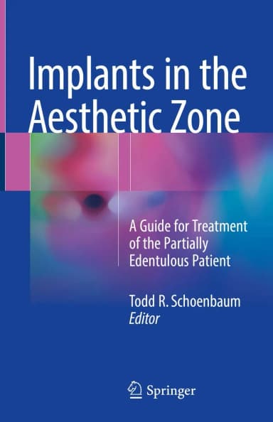 Image of - Implants in the Aesthetic Zone | Hardcover
