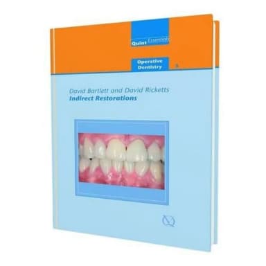 Image of - Indirect Restorations | Hardcover
