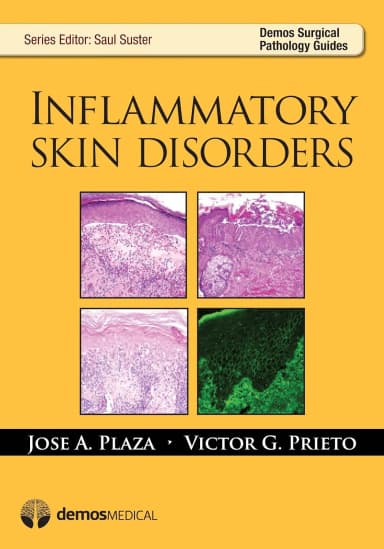 Image of - Inflammatory Skin Disorders | Paperback