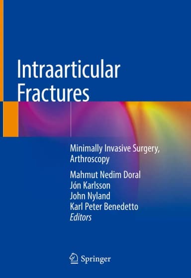 Image of - Intraarticular Fractures | Hardcover