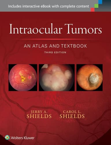 Image of - Intraocular Tumors An Atlas and Textbook | Third Edition | Hardcover
