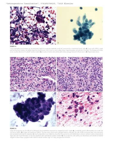 Image of - Intraoperative Consultation Foundations in Diagnostic Pathology | Hardcover