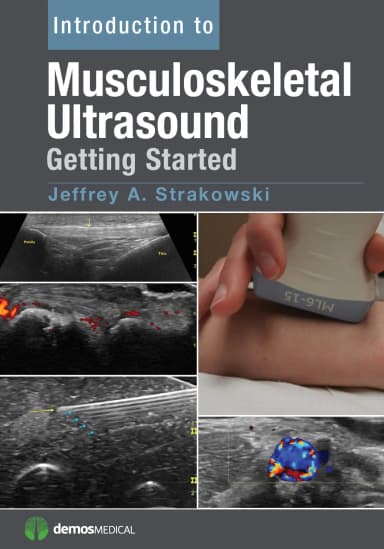Image of - Introduction to Musculoskeletal Ultrasound Getting Started | Paperback