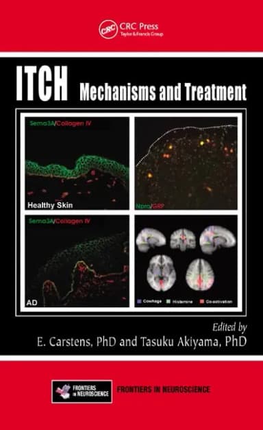 Image of - ITCH Mechanisms and Treatment | Hardcover