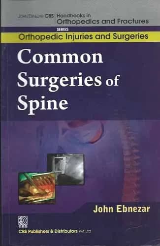 Image of - John Ebnezar Series | Common Surgeries of Spine