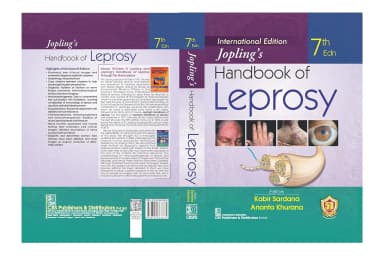 Image of - Joplings Handbook Of Leprosy | 7th Edition | Hardcover(IE)