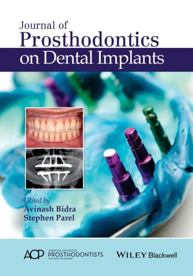 Image of - Journal of Prosthodontics on Dental Implants | Hardcover