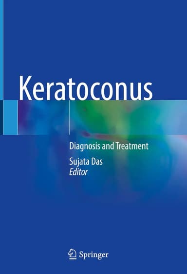 Image of - Keratoconus Diagnosis And Treatment | Hardcover