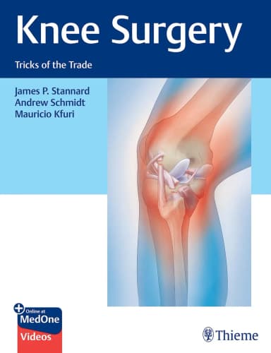 Image of - Knee Surgery Tricks Of The Trade | Hardcover