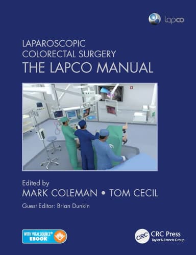 Image of - Laparoscopic Colorectal Surgery The Lapco Manual | Paperback