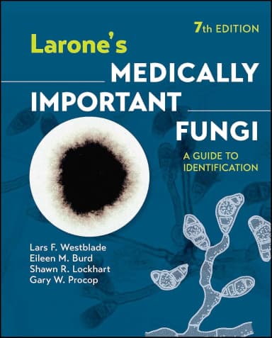 Image of - Larones Medically Important Fungi A Guide To Identification 7th Edition | Hardcover