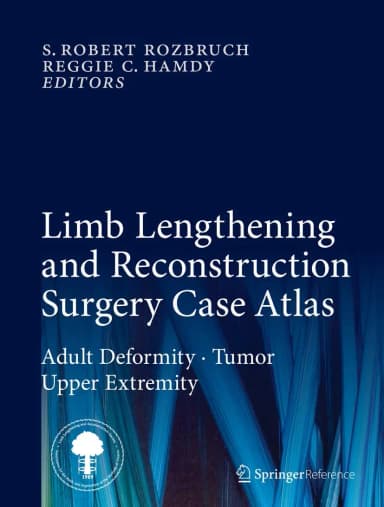 Image of - Limb Lengthening and Reconstruction Surgery Care Atlas | Hardcover