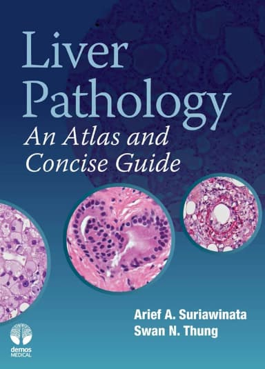 Image of - Liver Pathology An Atlas and Concise Guide | Hardcover