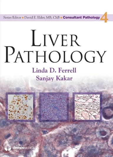 Image of - Liver Pathology | Hardcover