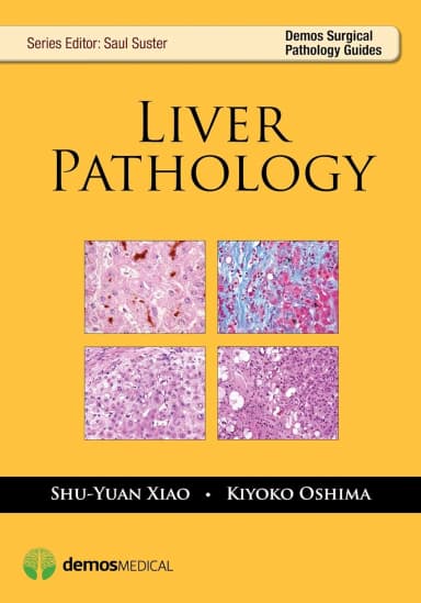 Image of - Liver Pathology | Paperback