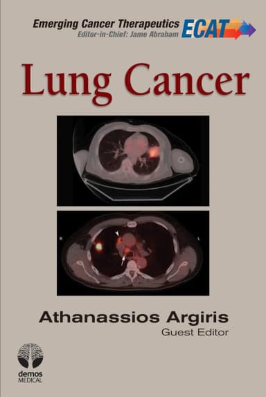 Image of - Lung Cancer | Hardcover