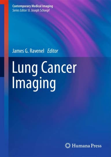 Image of - Lung Cancer Imaging | Hardcover