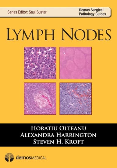 Image of - Lymph Nodes | Paperback