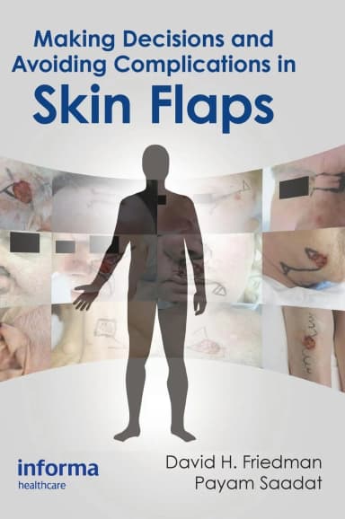 Image of - Making Decisions and Avoiding Complications in Skin Flaps | Hardcover